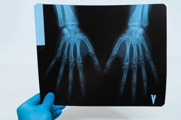 Виды артрита, которые можно обнаружить на рентгене
