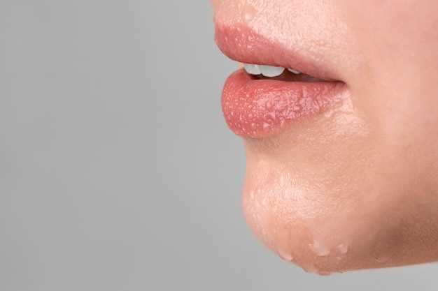 Влияние погодных условий на появление дерматита на губах